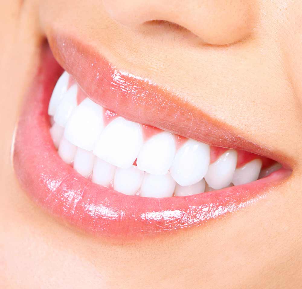 close up of a healthy white smile thanks to our teeth whitening in Poway, CA