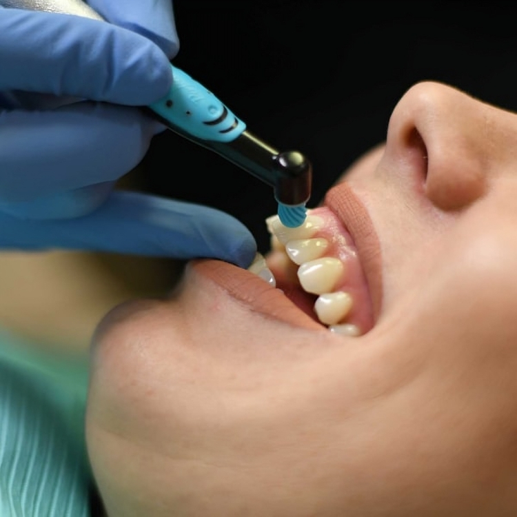 The dentist cleaning the teeth of a woman who is lying down