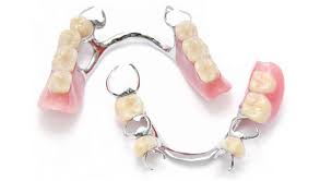 Partial Dentures