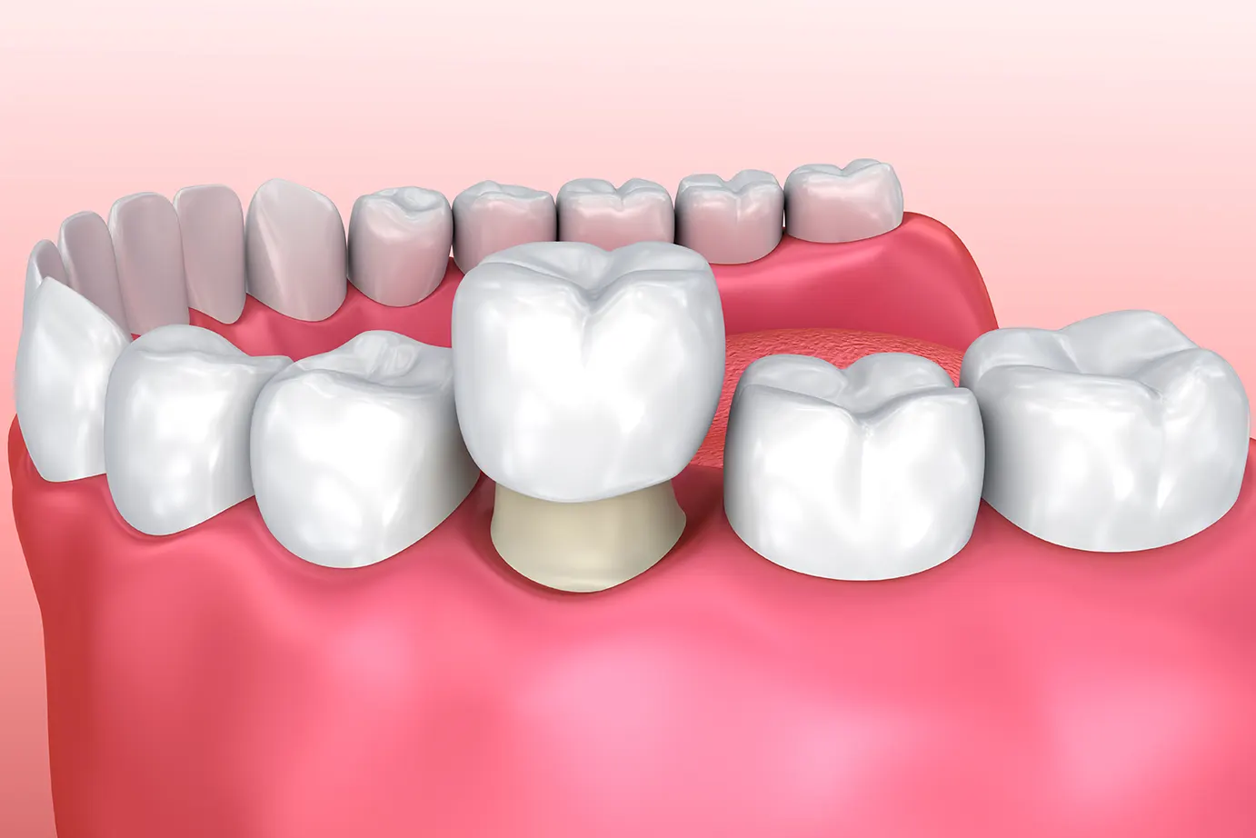 Poway Family Dentist Dr. Joe Nguyen